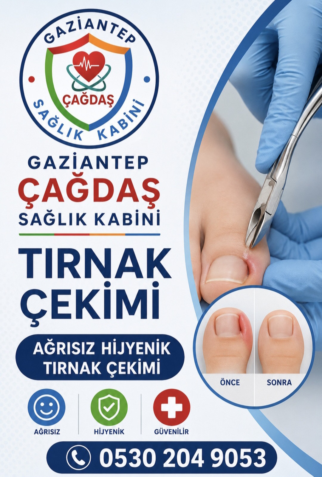 Tırnak Çekimi